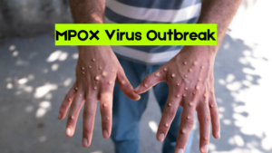 MPOX Virus Outbreak: Understand Threat and Implications for Global Health!